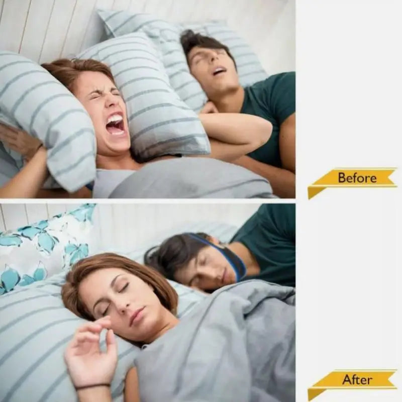 2 Pack Stop Snoring Snore Belt Anti Snore Chin Strap Sleep Apnea Chin Support Straps For Woman Man Health Care Sleeping Aid Tool
