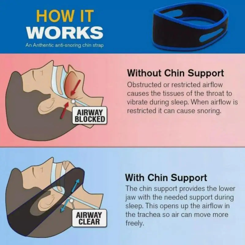 2 Pack Stop Snoring Snore Belt Anti Snore Chin Strap Sleep Apnea Chin Support Straps For Woman Man Health Care Sleeping Aid Tool